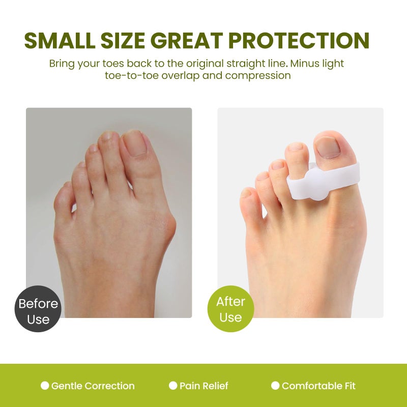 Bukihome Toe Separators Bunion Corrector - 8 Pack Big Toe Spacers with 2 Loops, Suitable for Bunion and Overlapping Toes, Reduce Foot Pain(White) - Image 2
